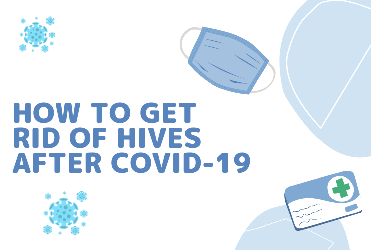 How to Get Rid of Hives After COVID-19