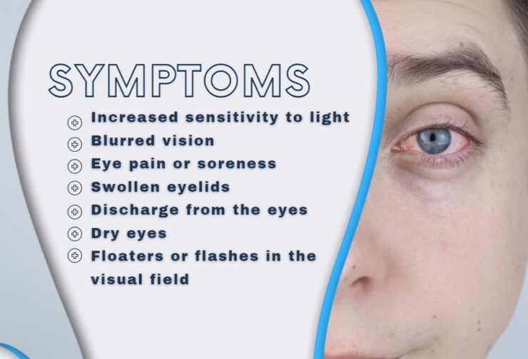 covid 19 eyes Symptoms